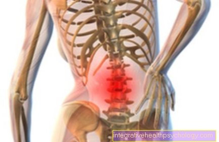 artroza sklepov ledvene hrbtenice
